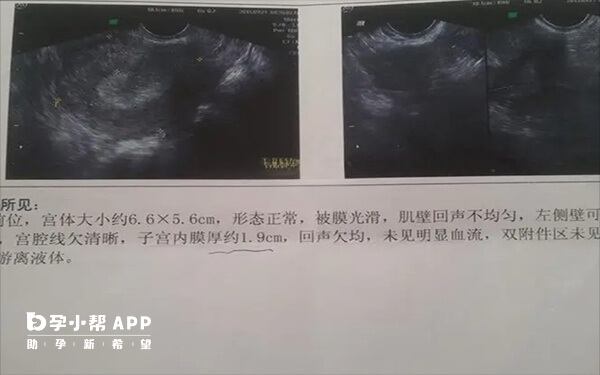 子宫内膜会激素的变化下发生改变