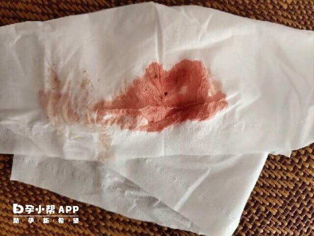 试管移植后阴道出血可能是着床了