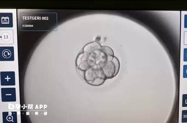 卵泡直径为18-22mm算成熟卵泡