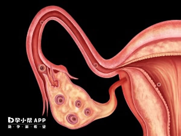 病理性卵泡多不利于怀孕