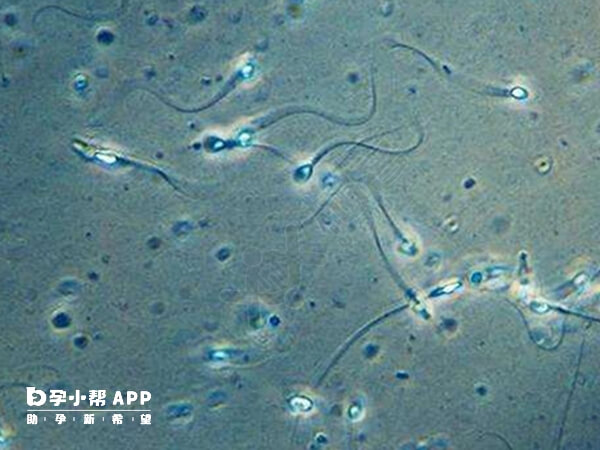 少精症会导致男性不育