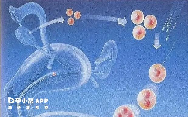 二代试管适合男性不孕