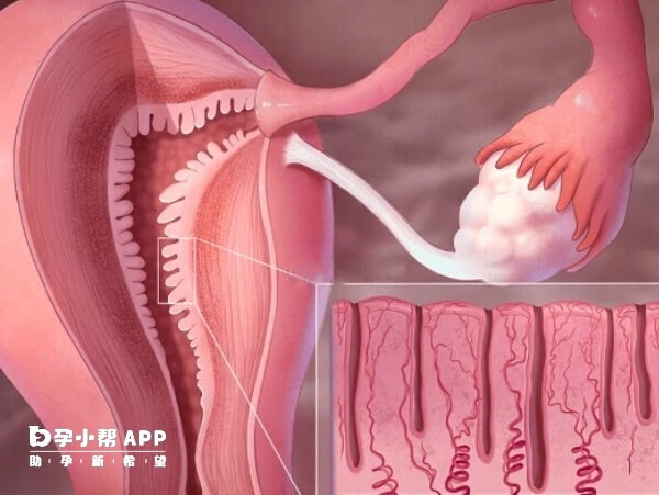 子宫内膜厚度会随着月经周期便