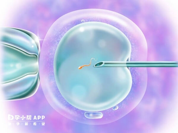 二代试管技术就是单精子显微注射技术