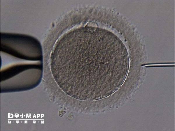 单精子注射技术可以帮助受精