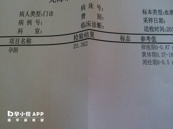 孕酮检测报告单
