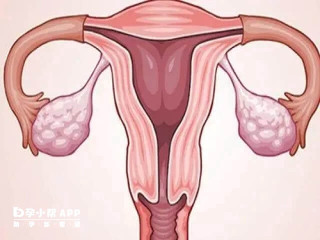 宫寒是中医的说法