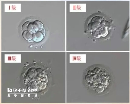 8细胞胚胎分四个等级