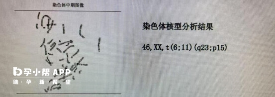 染色体核型分析结果