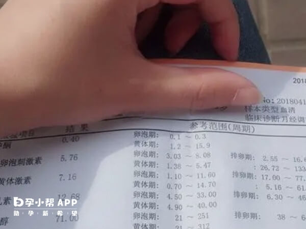 激素六项检查的准确时间不可一概而论