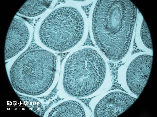 窦卵泡数目较多者也比较适合拮抗剂方案