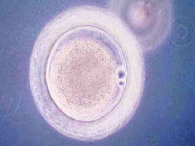 试管婴儿胚胎质量一级二级三级怎么分？有什么区别？
