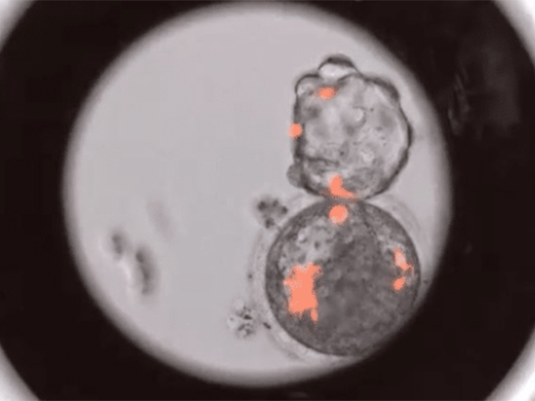 囊胚5bc移植成功率