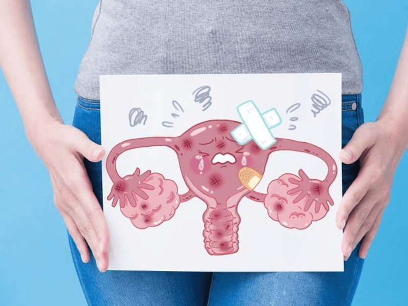 子宫内膜异位症的怀孕方法