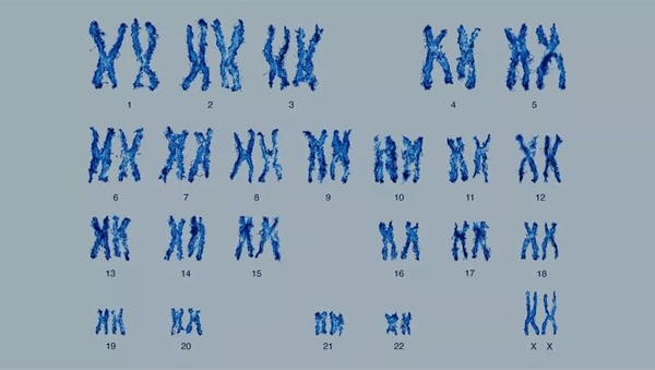 染色体核型检查