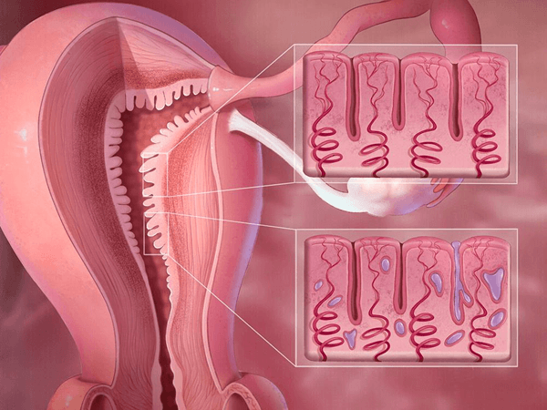 子宫内膜由三层膜组成