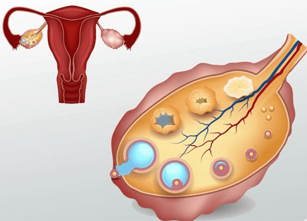 卵巢功能离不开卵泡刺激素的调节