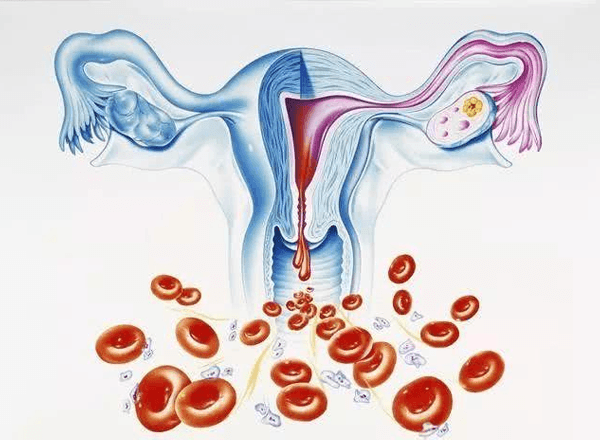 不孕不育是排卵障碍常见症状