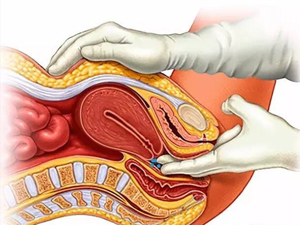 子宫内膜异位症可以通过腹腔镜检查出来