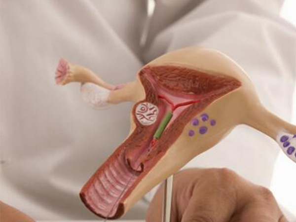 输卵管堵塞通常使用造影术检查