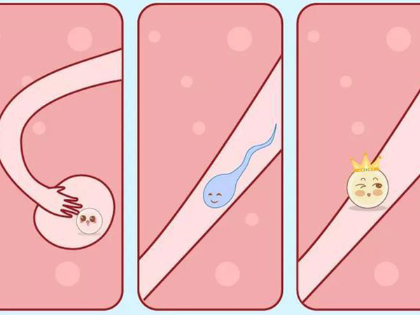 输卵管粘连会降低生育率