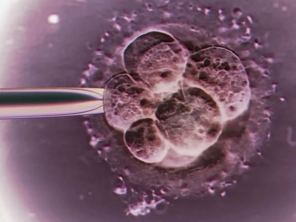 胚胎配成率与精卵质量有关