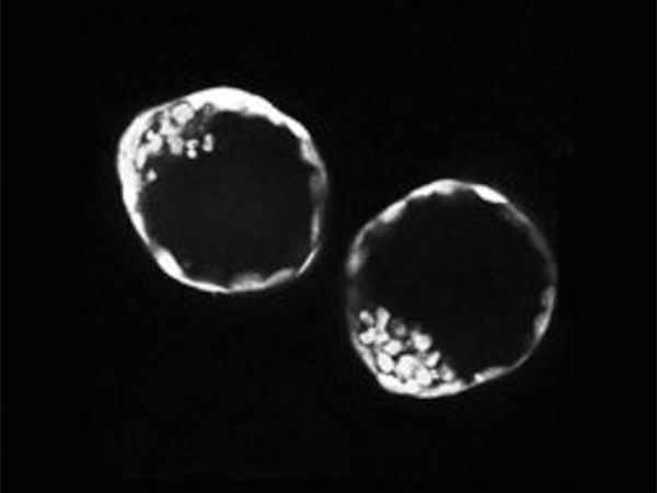 4cb胚胎移植操作优于6cb
