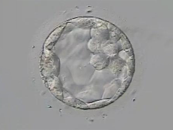 6c1胚胎碎片少