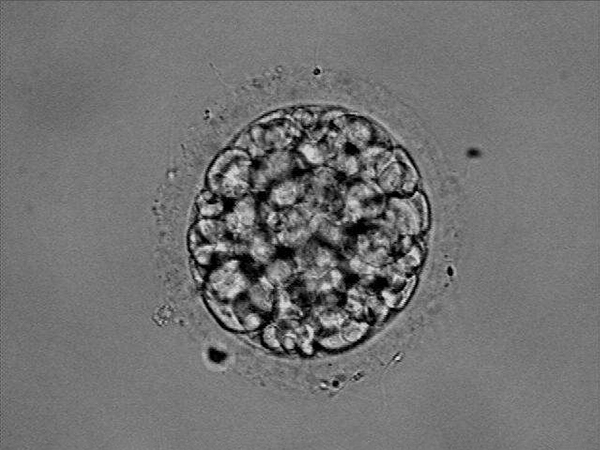 7细胞2级胚胎碎片较较少