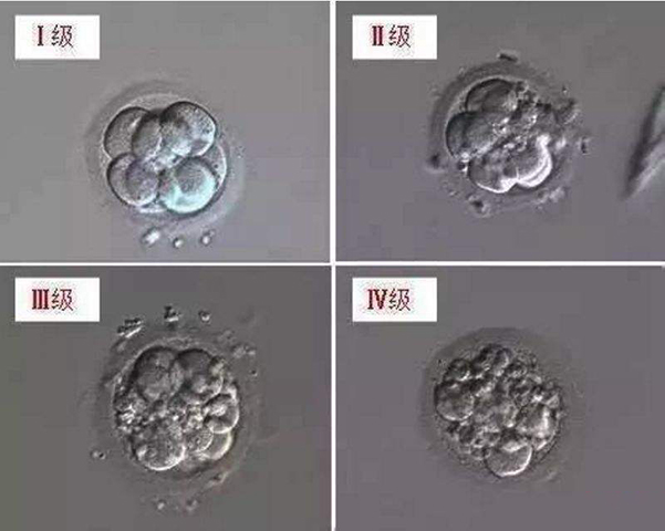 四级胚胎是最差的