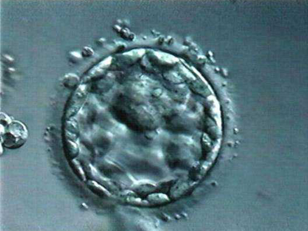 8c2胚胎属于是优胚