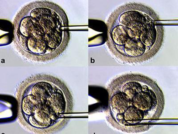 12c胚胎分为一二三四级