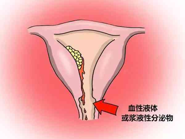 孕期出血用孕康颗粒好还是保胎灵的保胎止血效果好呢？